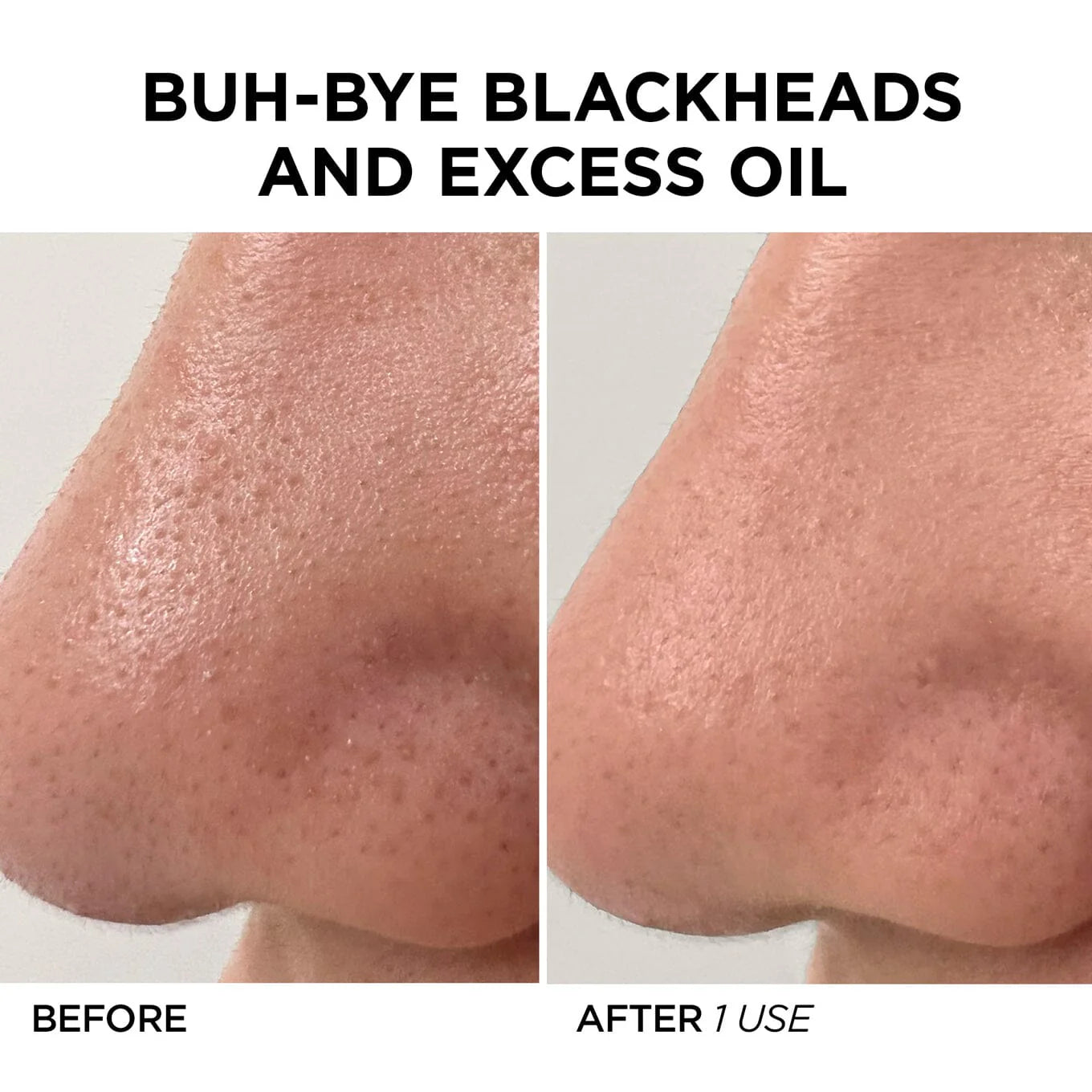 BeautyBio The Glofacial Basic Set in Pakistan