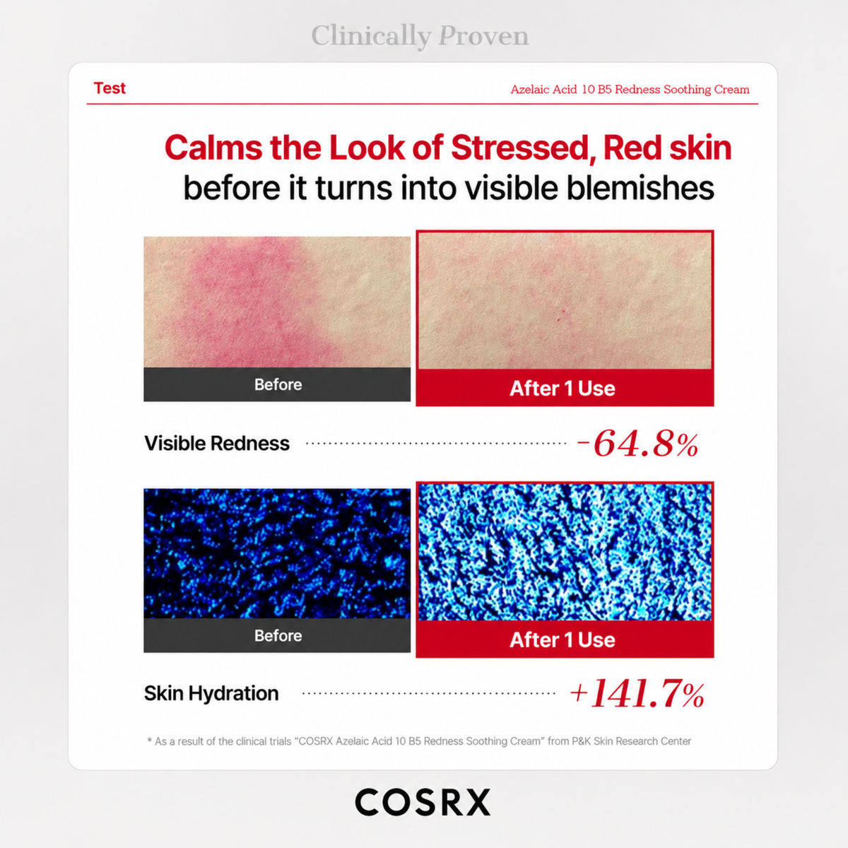 COSRX Azelaic Acid 10 B5 Cream Redness Soothing Cream product image