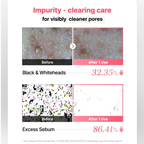 COSRX Red Rice Inositol Exfoliating Care Pore Peel Serum