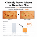 Celimax Pore+Dark Spot Brightening Pad
