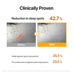Celimax Pore + Dark Spot Brightening Serum