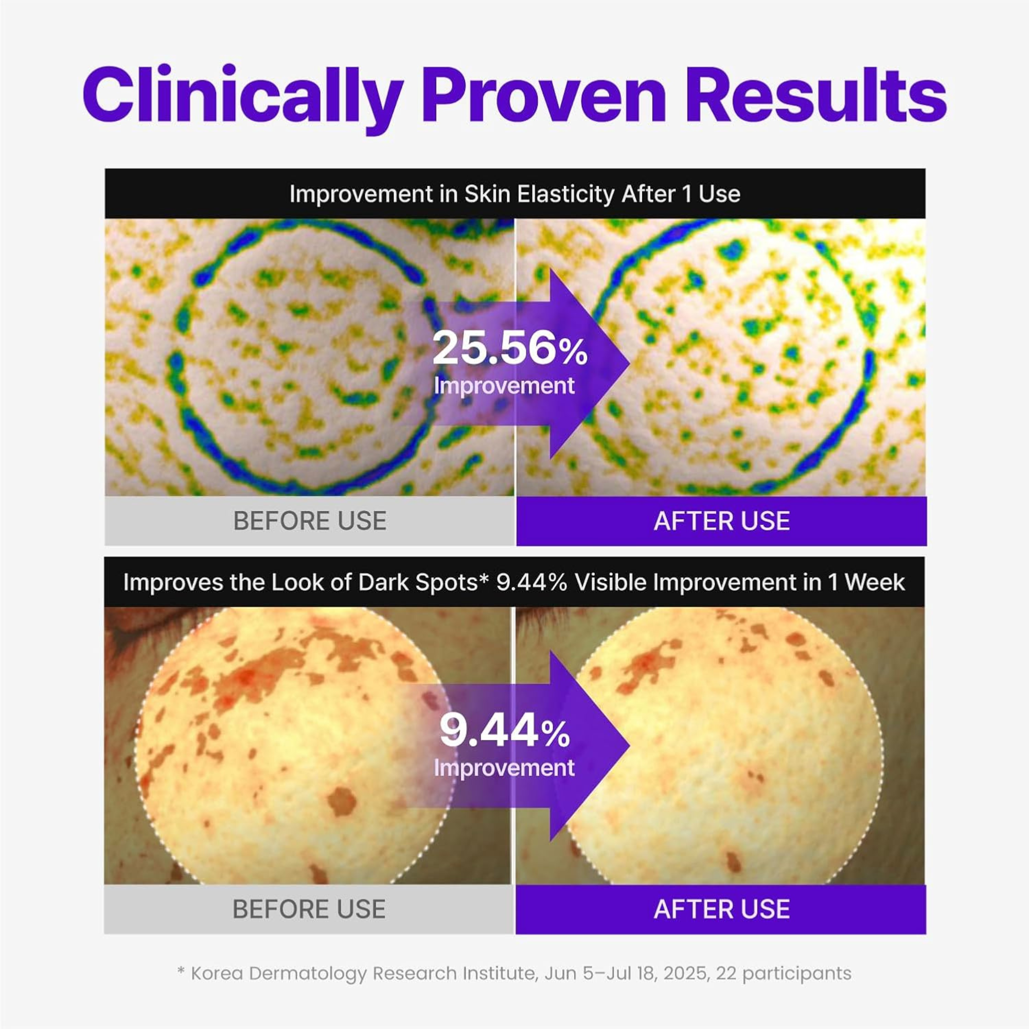 Centellian24 Expert Madeca Cream Active Renew PDRN