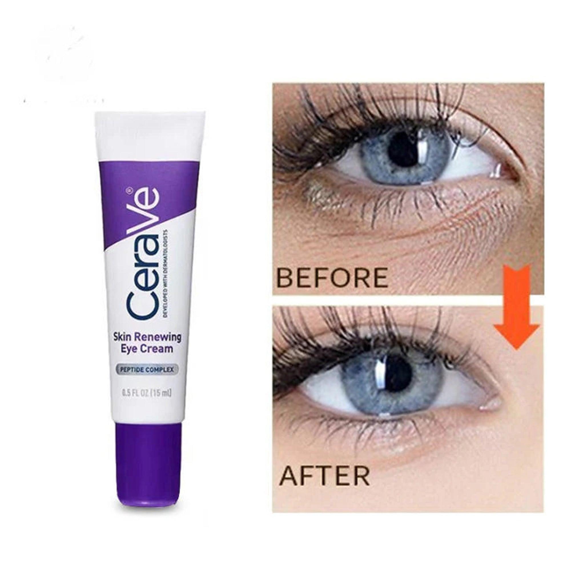 CeraVe Skin Renewing Eye Cream 15ml - TheSkinFit