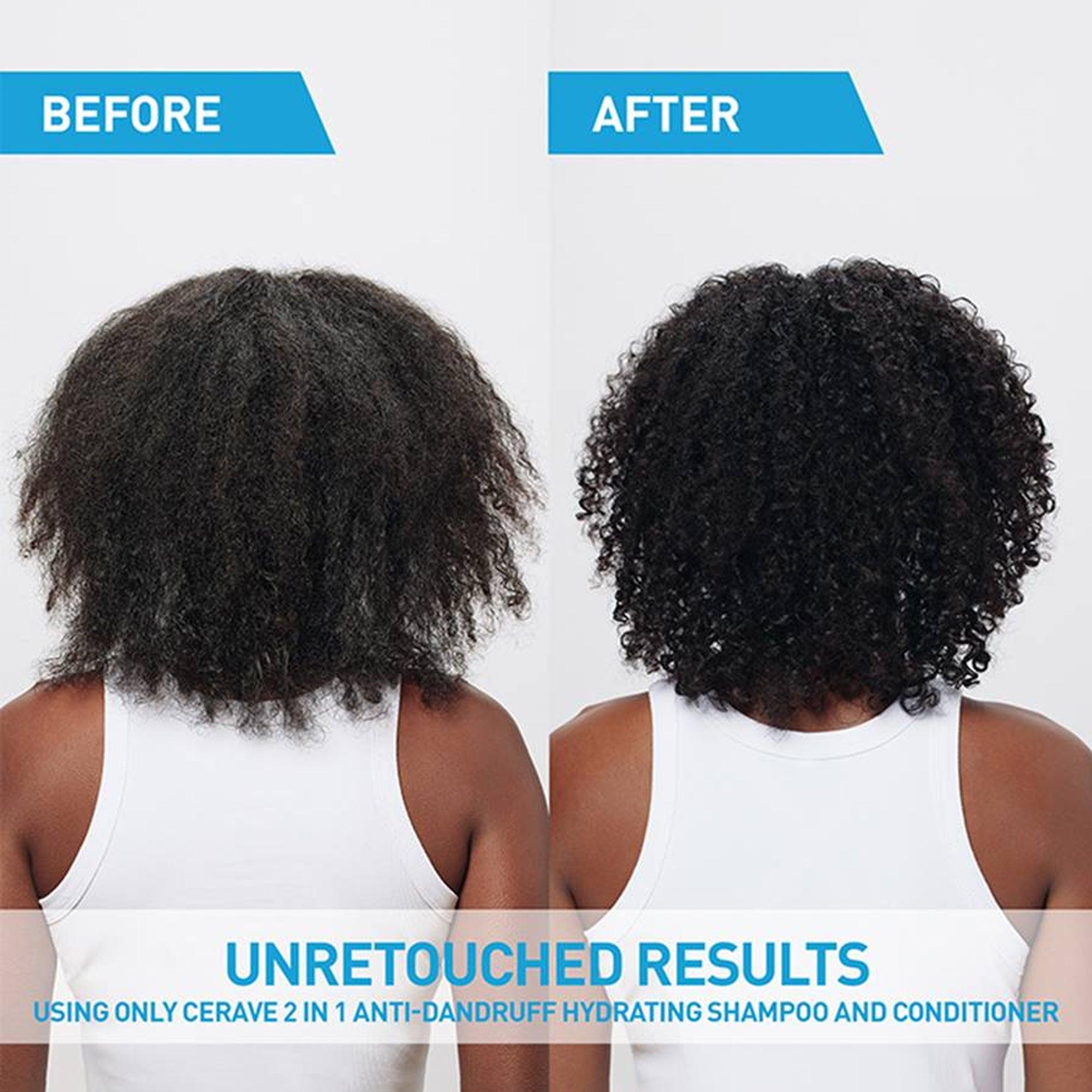 CeraVe 2-in-1 Anti-Dandruff Hydrating Shampoo and Conditioner 355ml - TheSkinFit