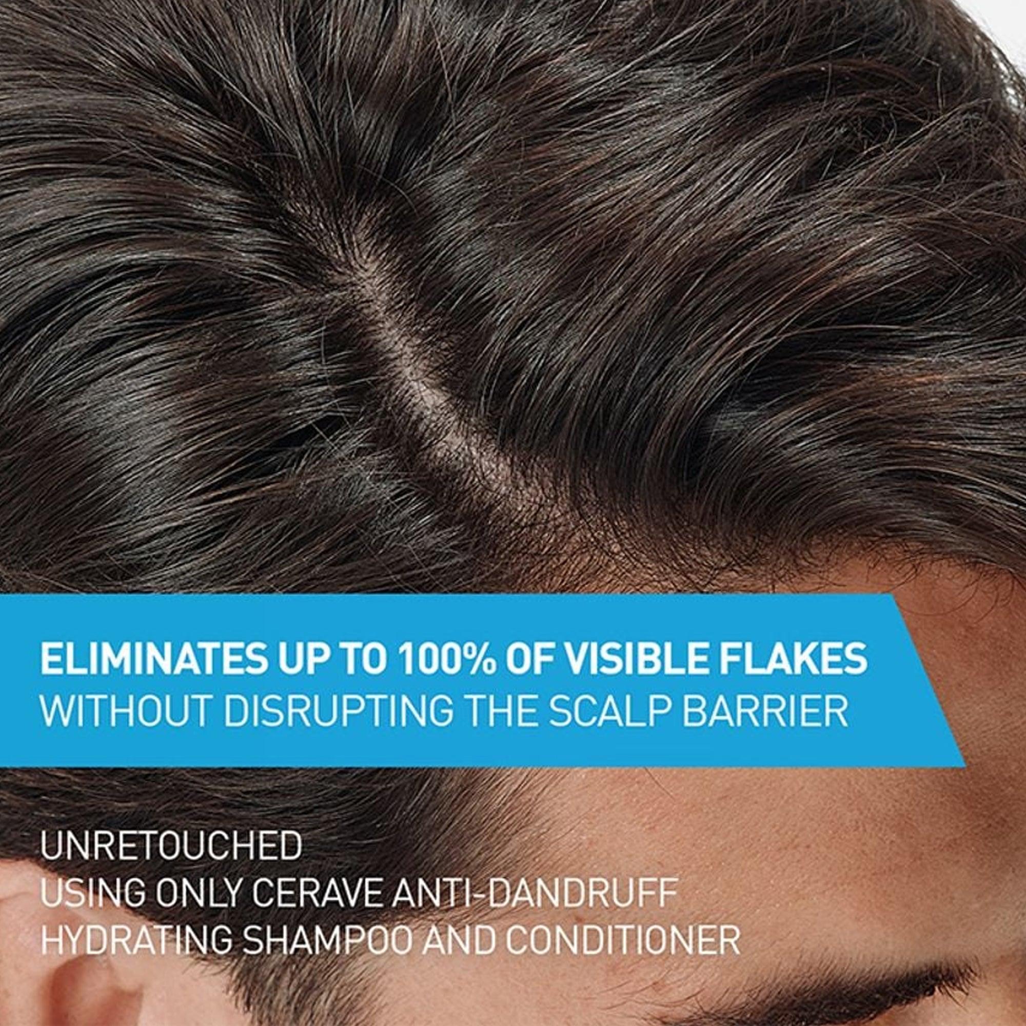 Cerave Anti-Dandruff Hydrating Conditioner 266ml - TheSkinFit