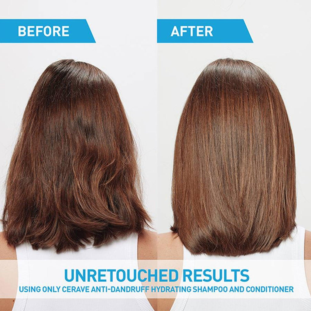 Cerave Anti-Dandruff Hydrating Conditioner 266ml - TheSkinFit