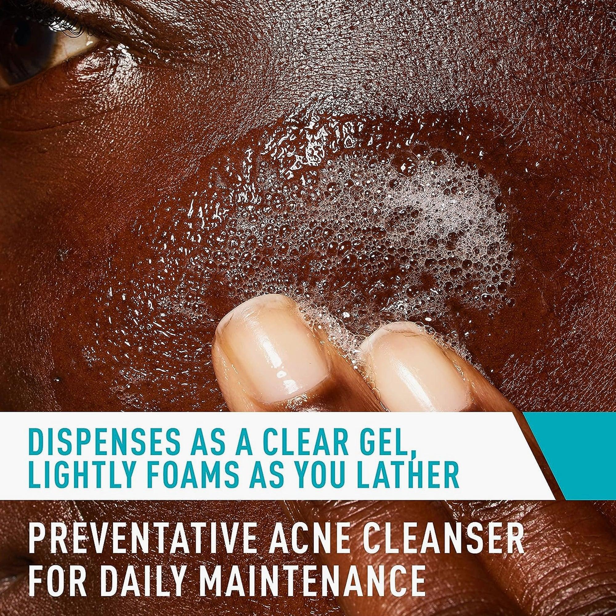 CeraVe Acne Control Cleanser 2% Salicylic Acid Acne Treatment 473ml - TheSkinFit