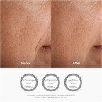 Dr. Althea Pure Retinol 0.15% Cream