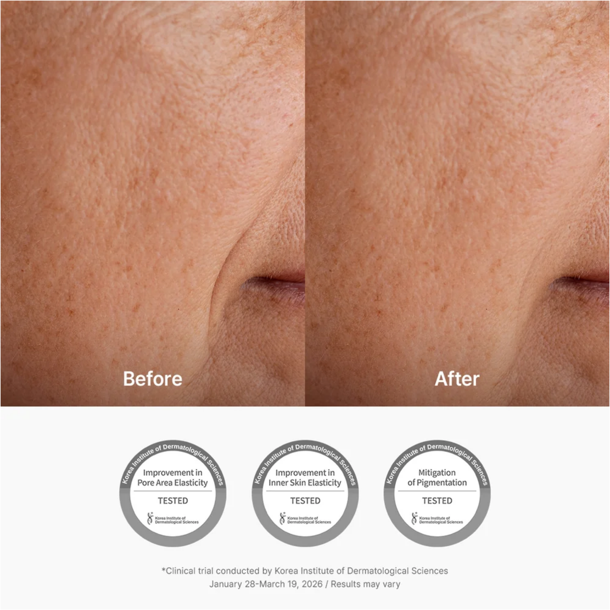 Dr. Althea Pure Retinol 0.15% Cream