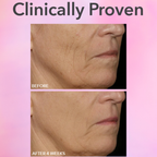 Dr. Dennis Gross Skincare DRx SpectraLite FaceWare Pro 3 Minute LED Device in Pakistan
