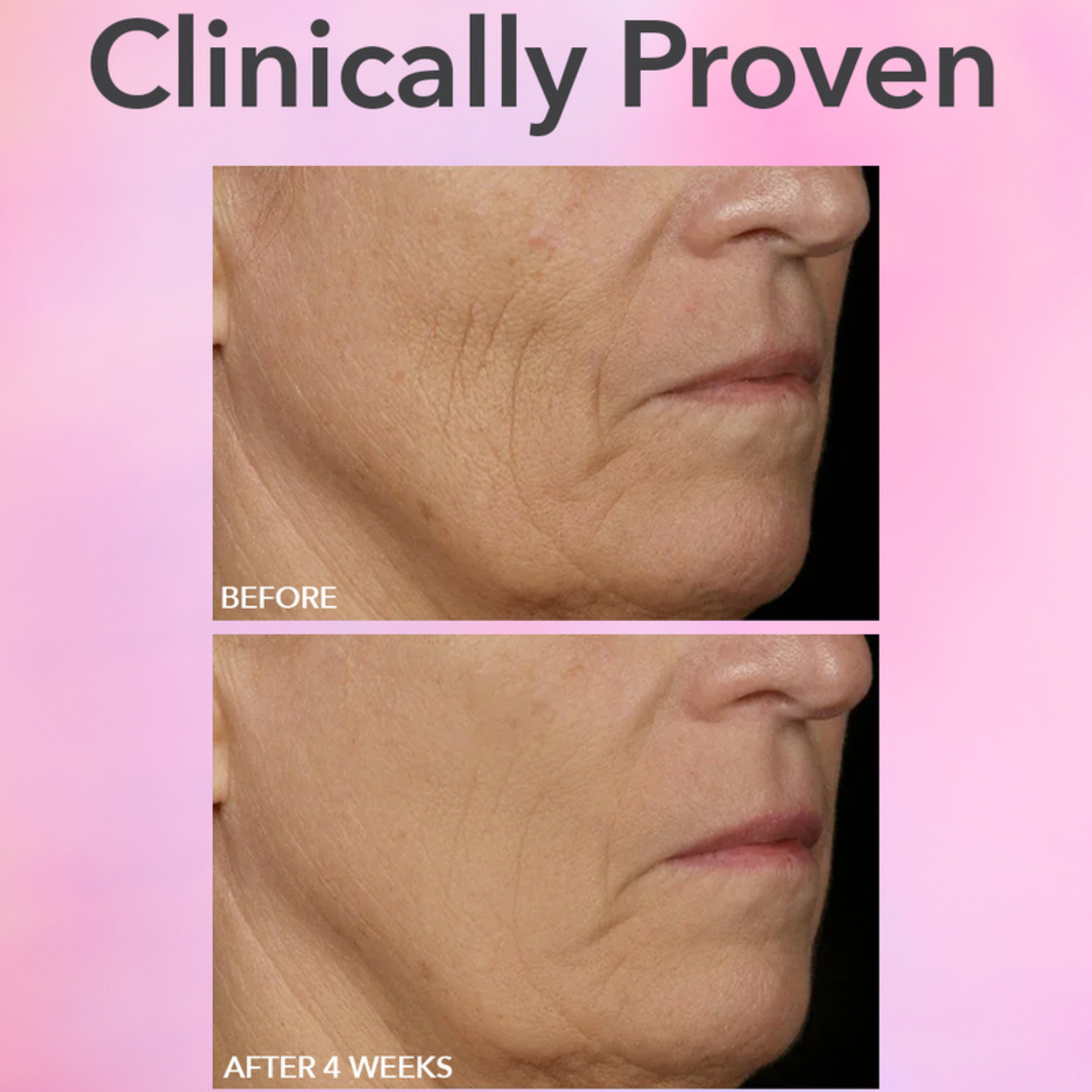 Dr. Dennis Gross Skincare DRx SpectraLite FaceWare Pro 3 Minute LED Device in Pakistan