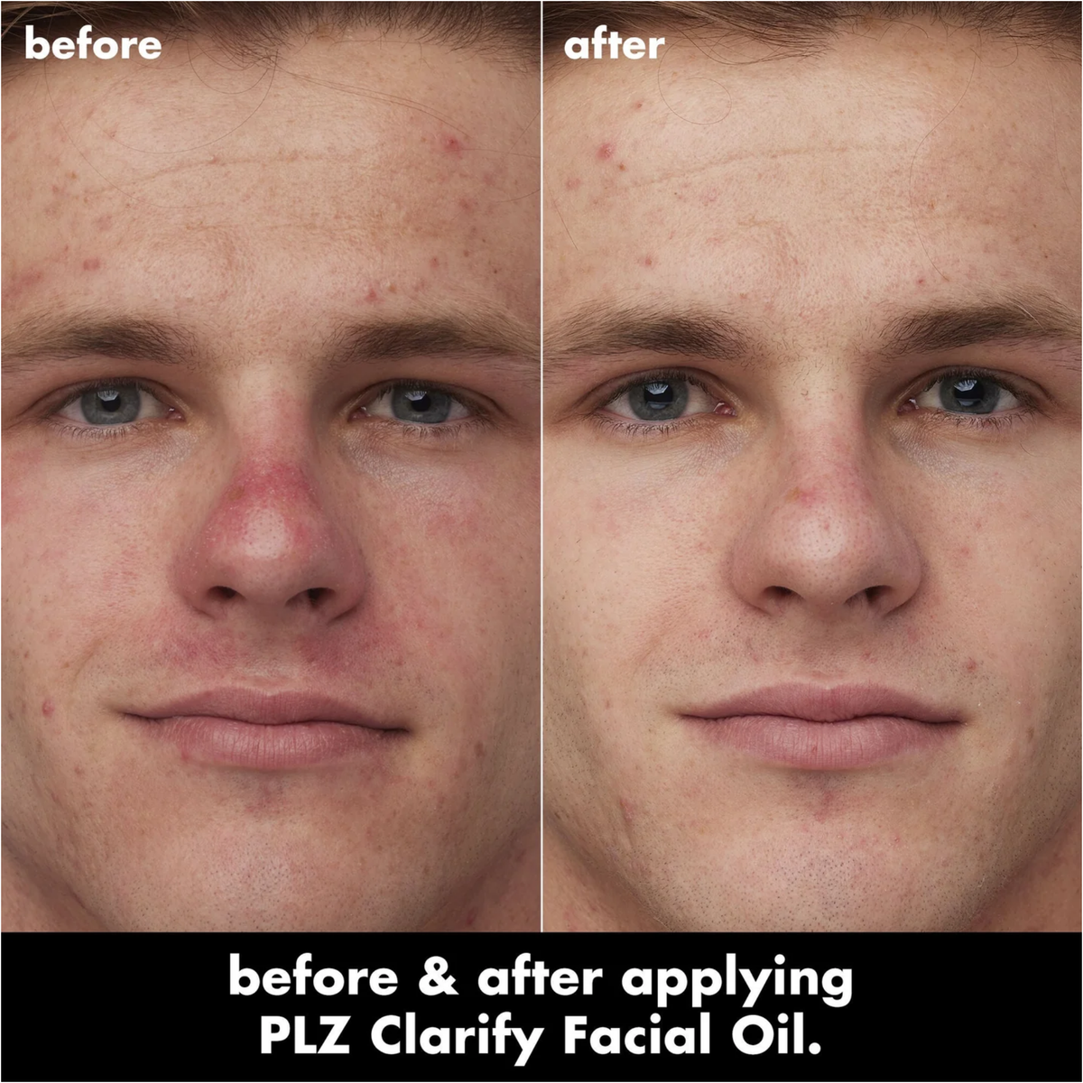 ELF SKIN PLZ Clarify Facial Oil 30ml