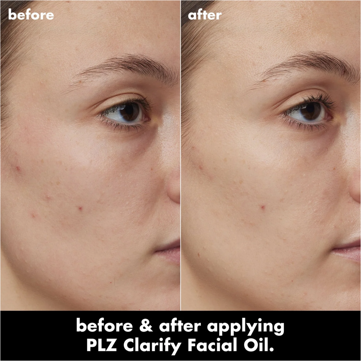 ELF SKIN PLZ Clarify Facial Oil 30ml