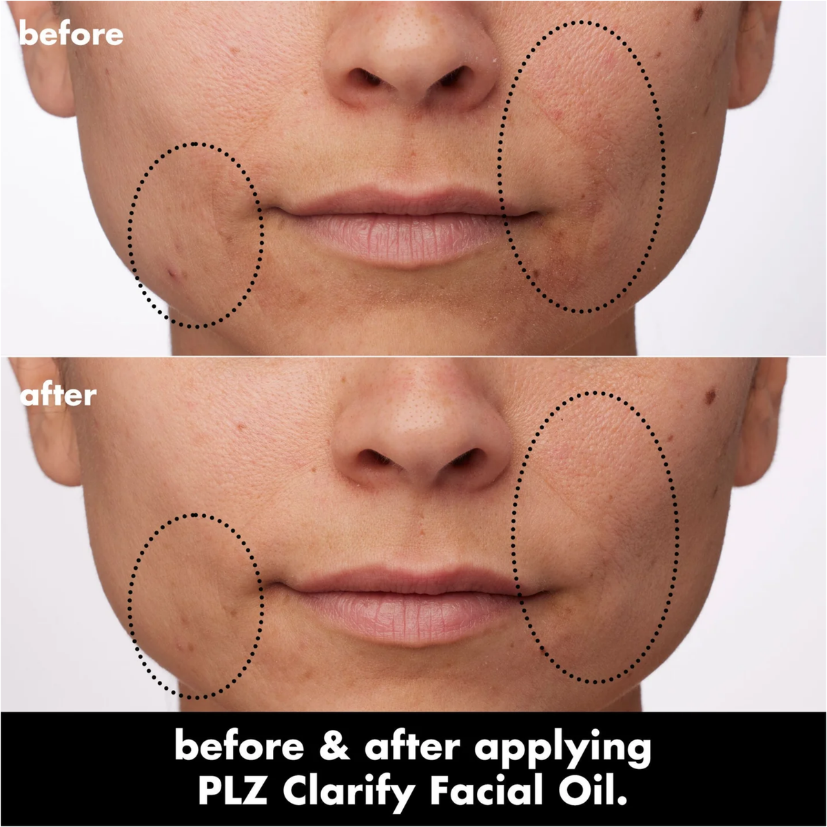 ELF SKIN PLZ Clarify Facial Oil 30ml