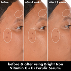 ELF Skin Bright Icon Vitamin C + E + Ferulic Serum 15ml