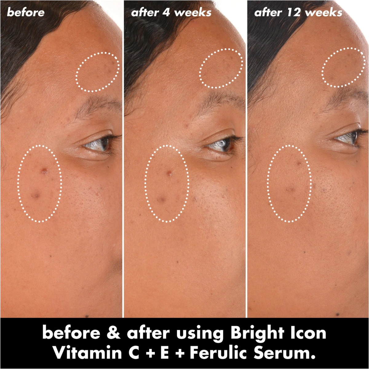 ELF Skin Bright Icon Vitamin C + E + Ferulic Serum 15ml