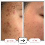 AccuFix Cosmetics Encapsulated Retinol + B5 Serum