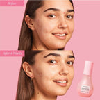 Glow Recipe Watermelon Glow Niacinamide Dew Drops 40ml Before | After Images