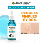 Garnier SkinActive Fast Clear Acne Prone Skin Booster Serum 15ml