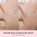 Glow Recipe Watermelon Glow Niacinamide Dew Drops 10ml