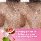 Glow Recipe Watermelon Glow PHA + BHA Pore Tight-Toner
