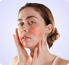 Sensitive & Redness