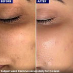 jenpharm dermive hyaluronic acid serum 20ml reviews