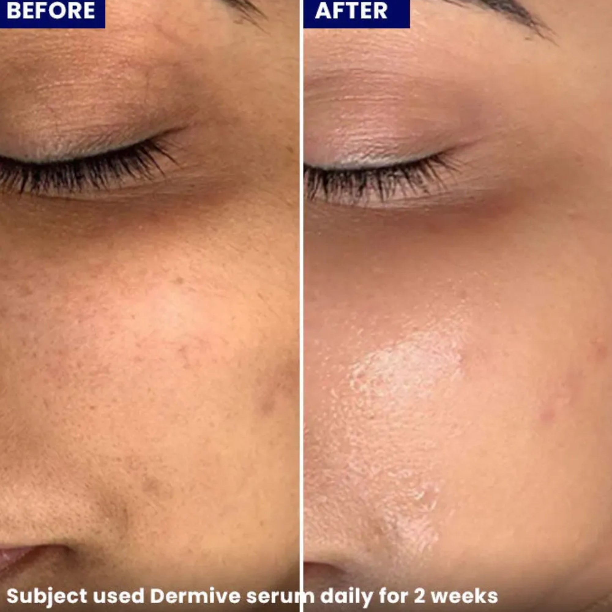 jenpharm dermive hyaluronic acid serum 20ml reviews