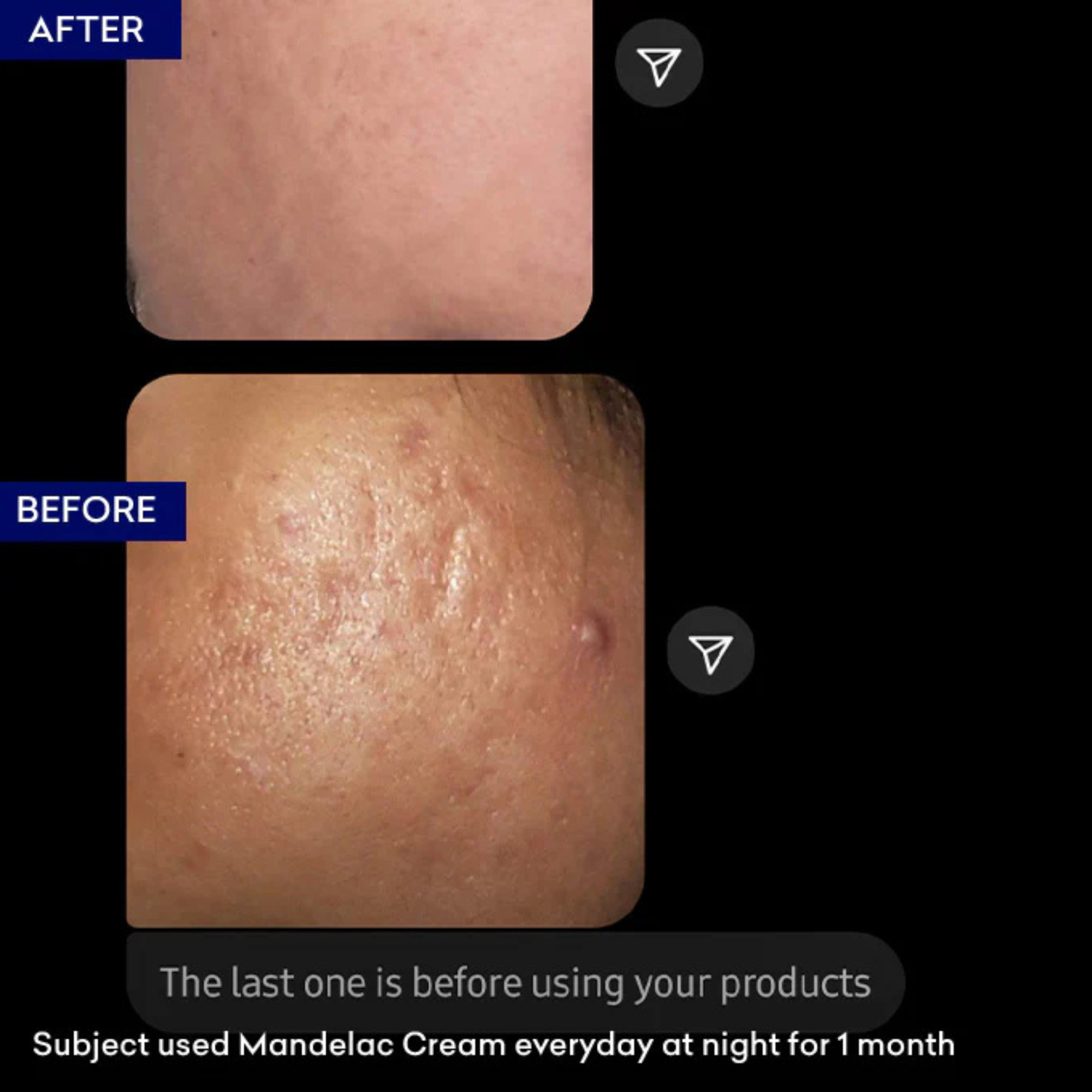 Jenpharm MandelAC Advanced Rejuvenating Cream 30gm