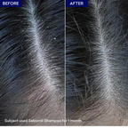 How to Use Jenpharm Sebornil Anti-Dandruff Shampoo 100ml