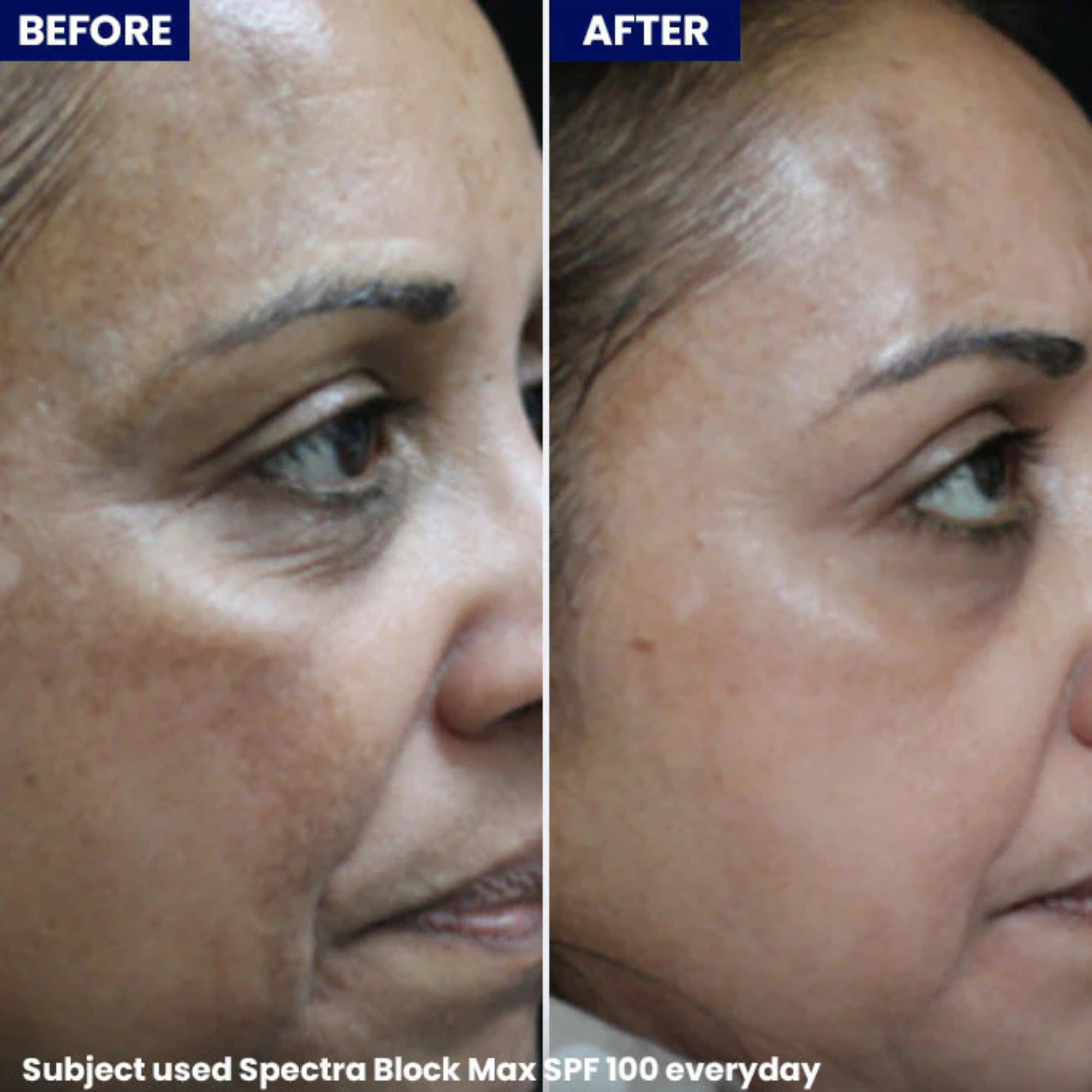 Jenpharm Spectra Block Max 100 SPF 100+++ For All Skin Types 40gm