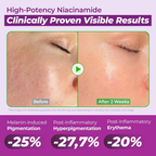 Jumiso 20% Niacinamide Dark Spot Correcting Serum