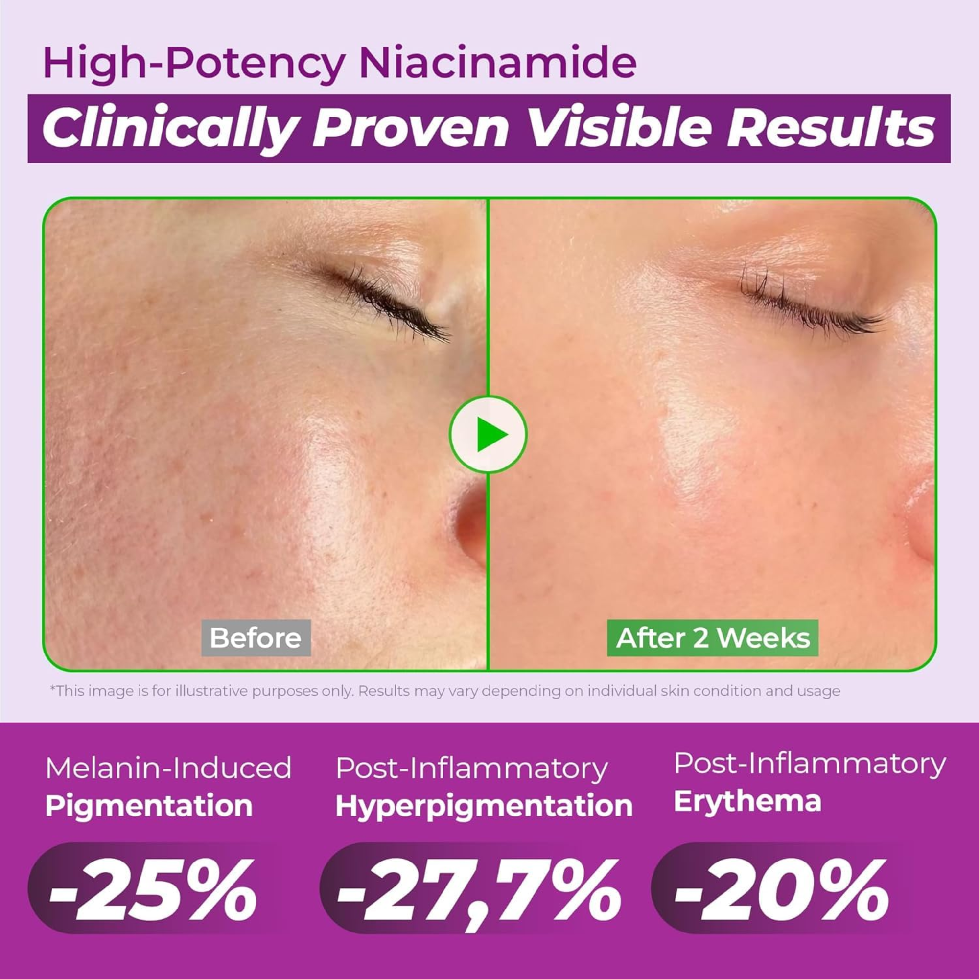 Jumiso 20% Niacinamide Dark Spot Correcting Serum