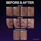La Roche-Posay Mela B3 Double Dose Discoloration Treatment with Melasyl