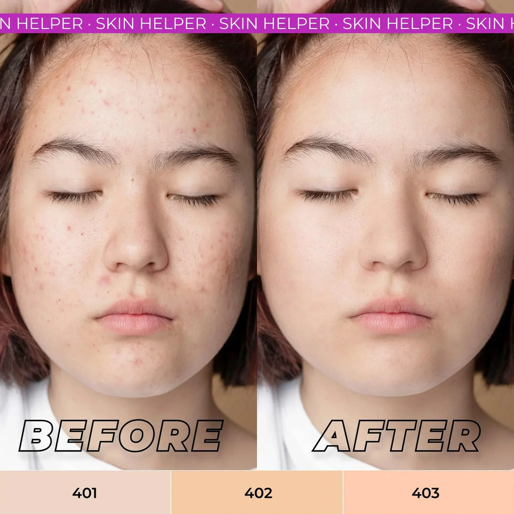 Lamel Oh My Clear Face Antibacterial Compact Powder 403 Rosy Beige 6gm