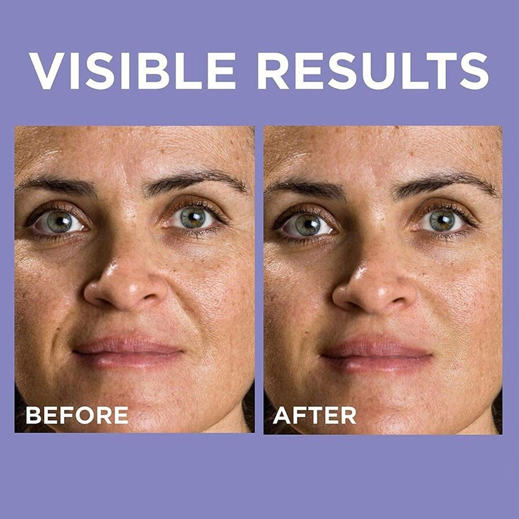 L'Oreal Paris Revitalift 1.5% Hyaluronic Acid Serum 15ml - TheSkinFit