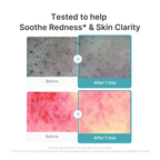 Medicube Azelaic Acid Capsule Cleansing Foam