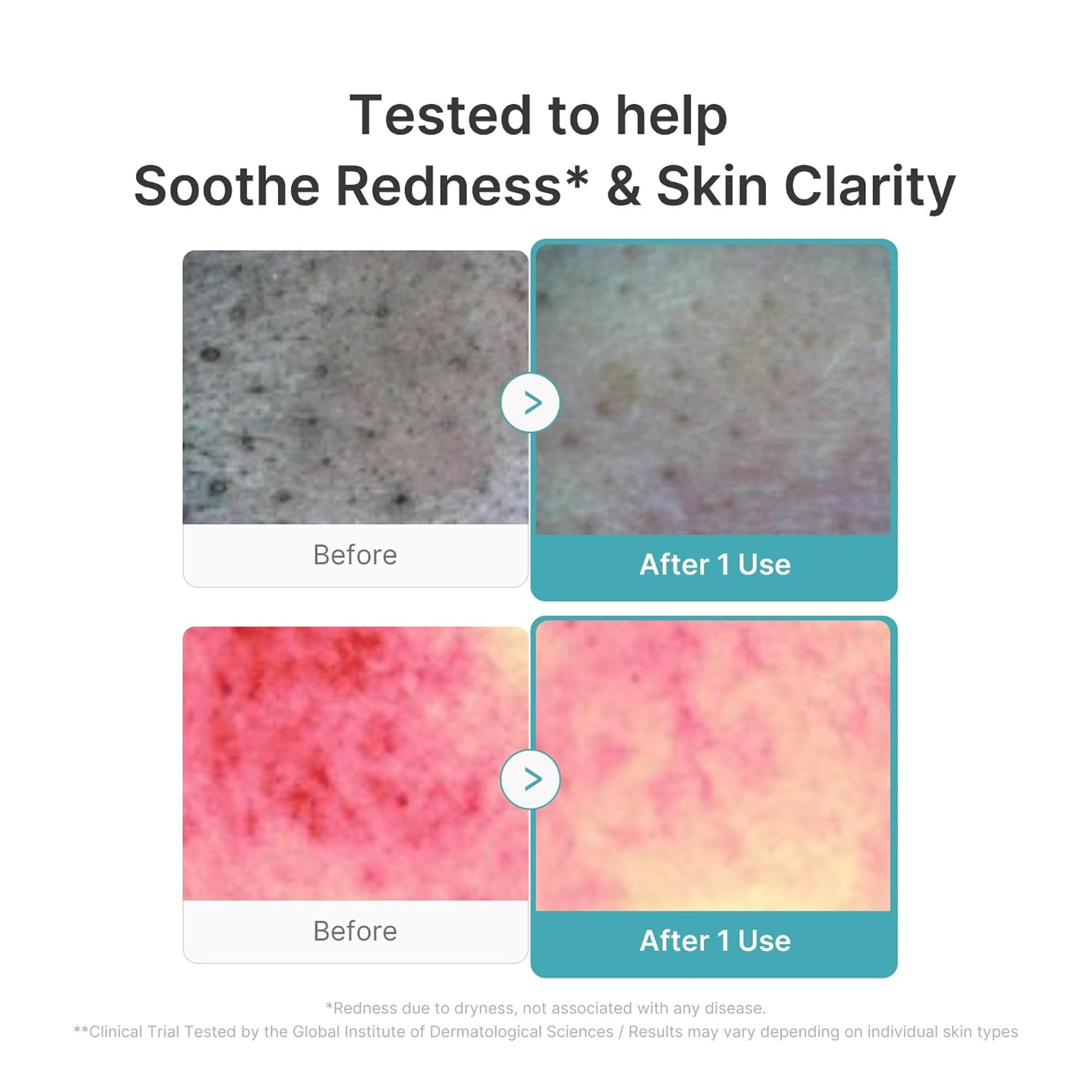 Medicube Azelaic Acid Capsule Cleansing Foam
