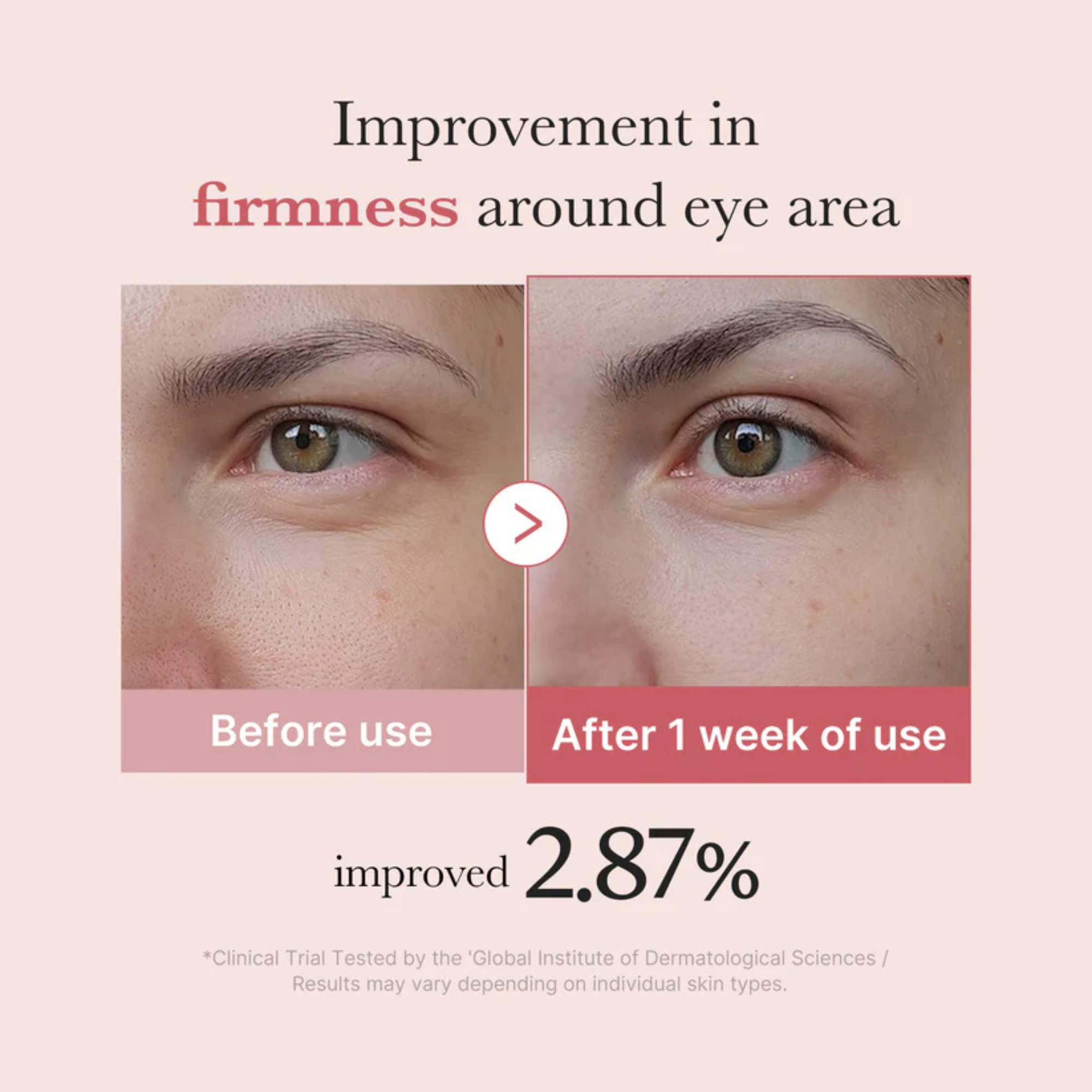 Medicube PDRN Pink Peptide Eye Cream 30ml