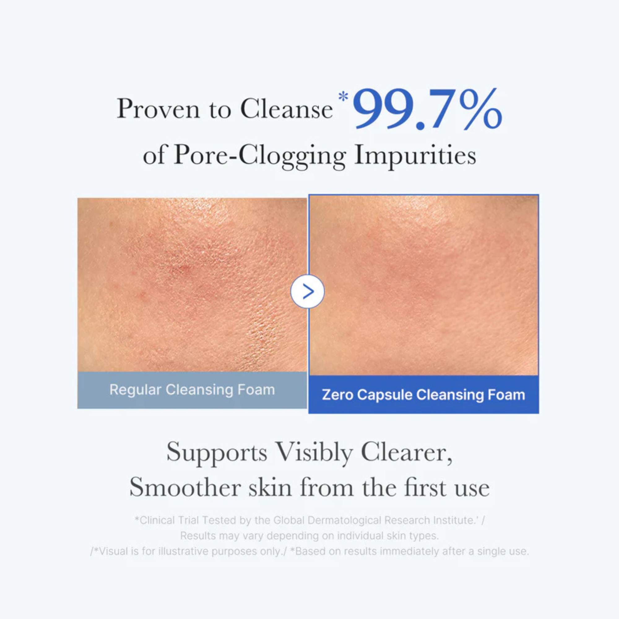 Medicube Zero Pore SA Clear Capsule Cleansing Foam 120gm