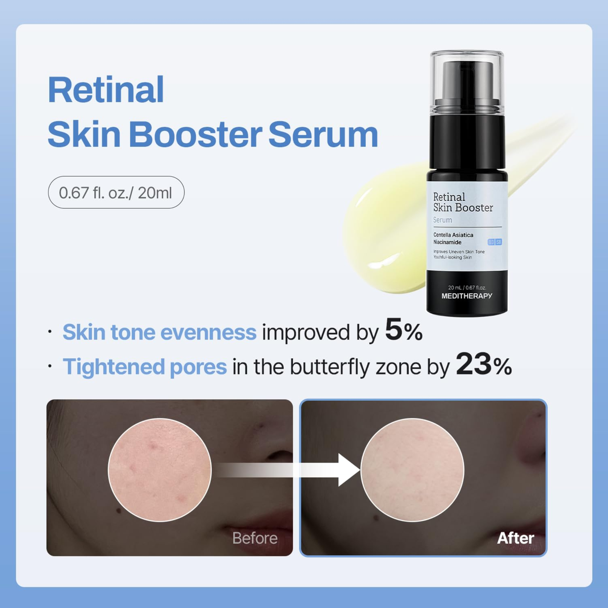 Meditherapy Gentle Boost Kit how to use