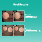 Meditherapy PDRN Skin Booster Serum ingredients