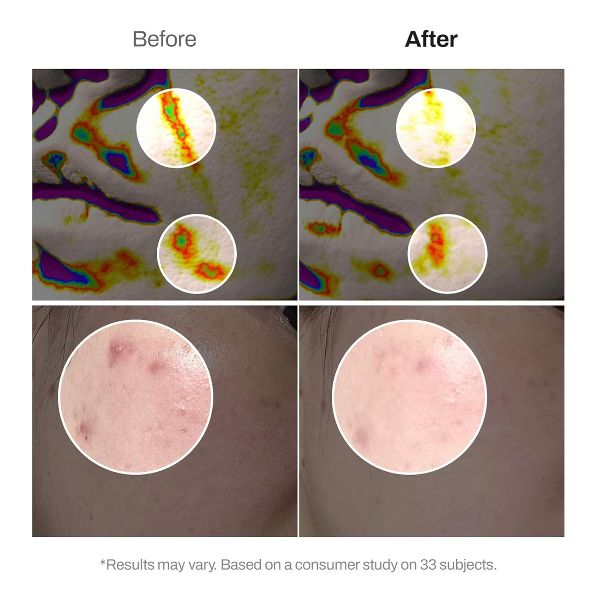 Meditherapy Retinal Skin Booster Serum ingredients