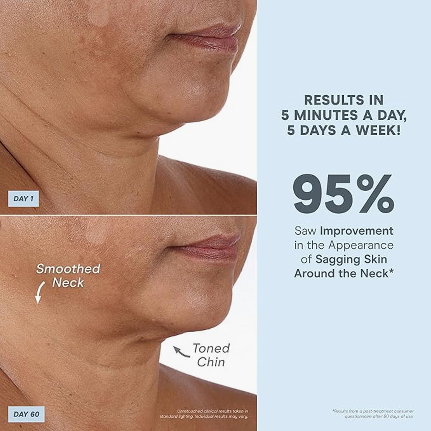 NuFACE Mini+ Starter Kit Violet Dusk