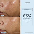 NuFACE Super Brighten + Correct Vita-C Booster Serum 30ml