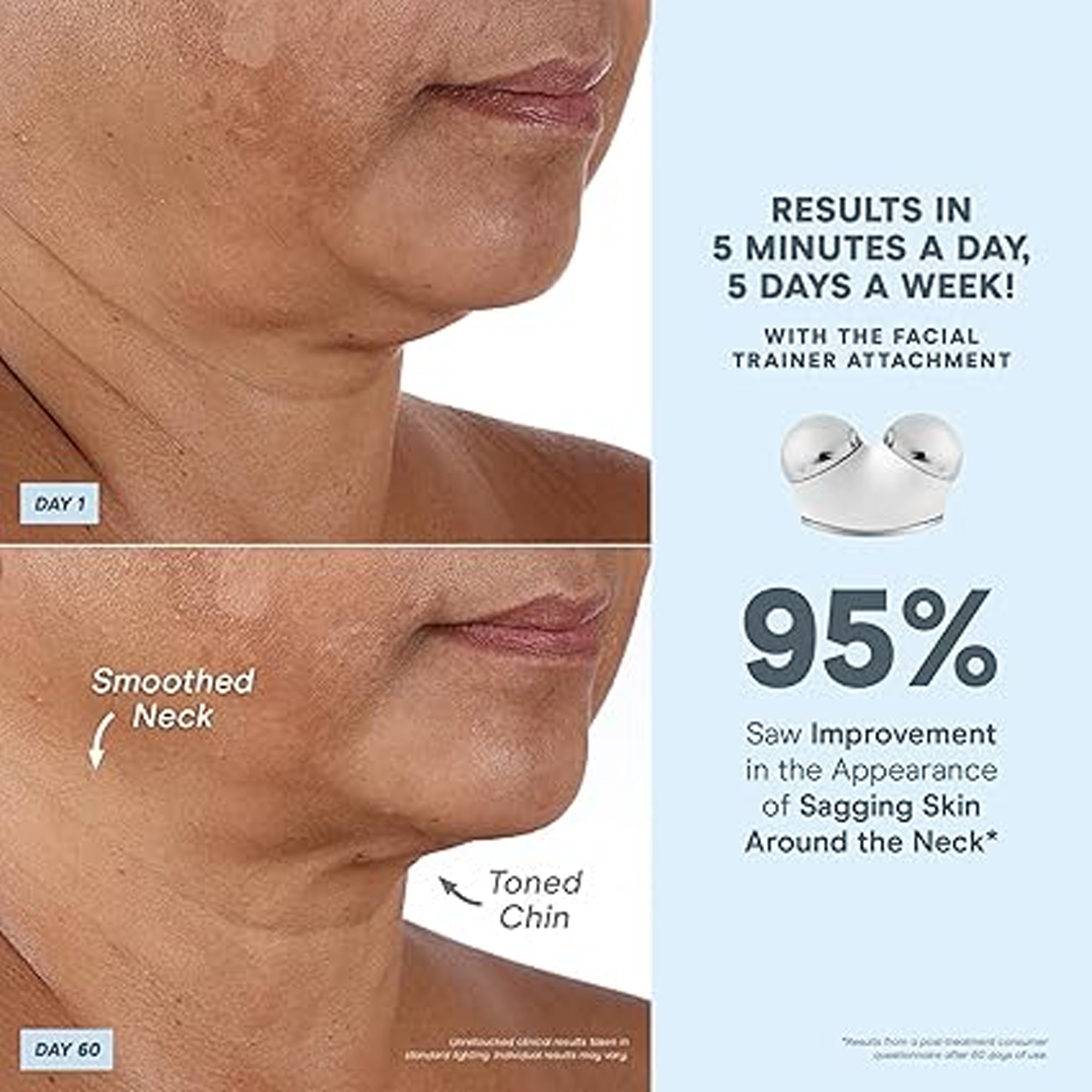 NuFACE Trinity Facial Toning Device + ELE Attachment