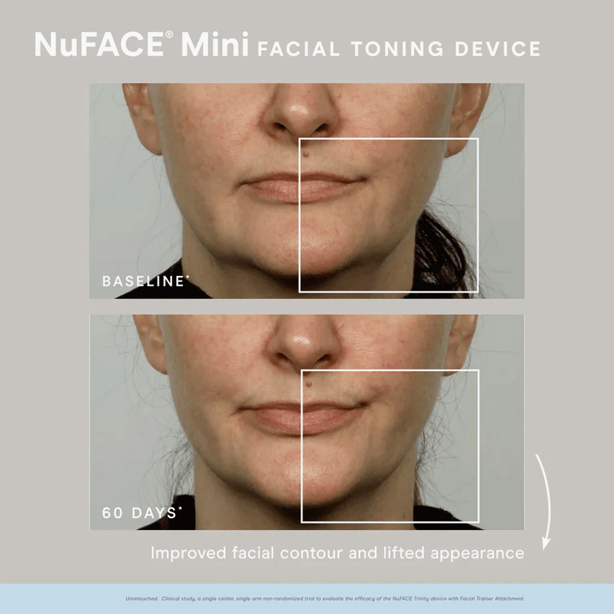 NuFace Mini Facial Tonning Device + Hydrating Aqua Gel 50ml