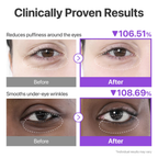 Numbuzin No.9 NMN + Collagen + 50 Peptides Under Eye Patches in Pakistan