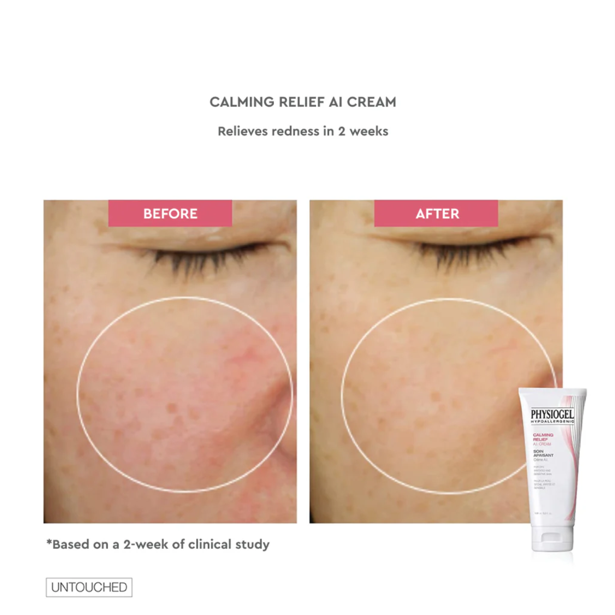 Physiogel Calming Relief A.I. Cream For Dry Irritated And Reactive Skin 50ml