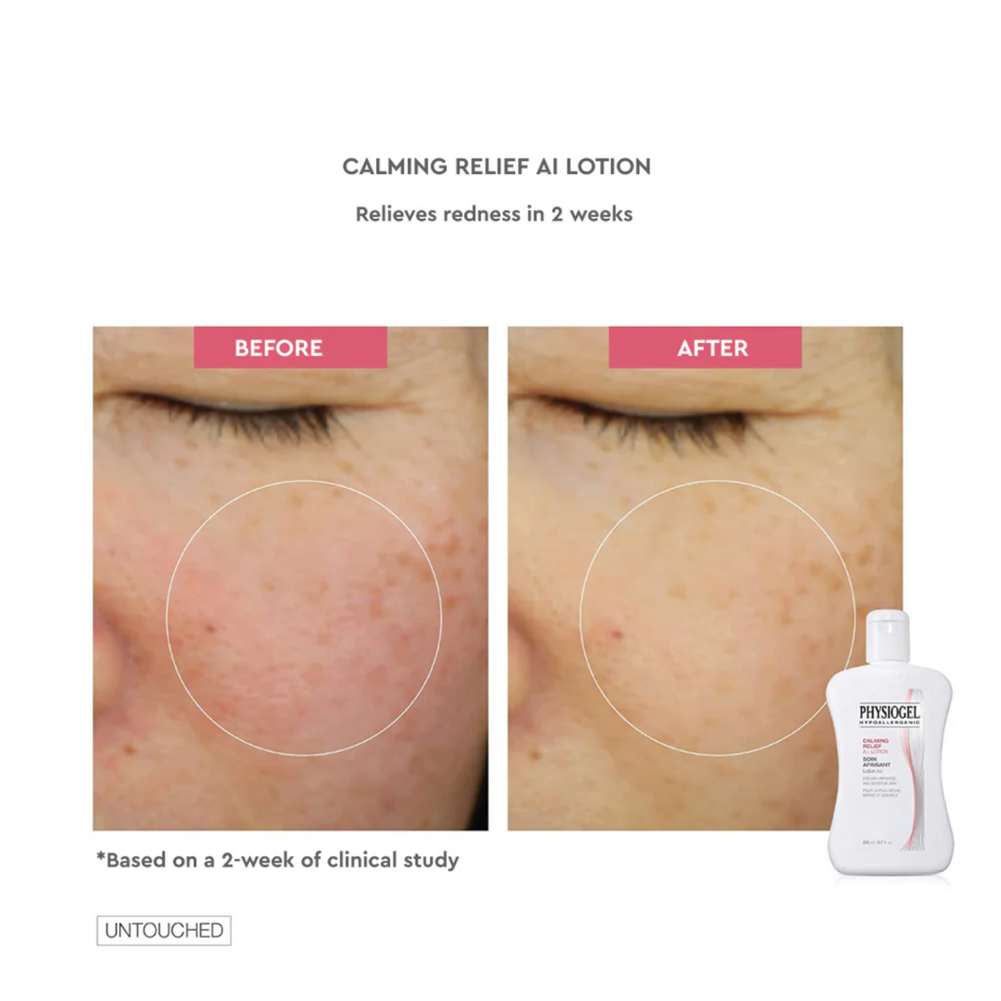 Physiogel Calming Relief A.I. Lotion For Dry Irritated And Reactive Skin 200ml